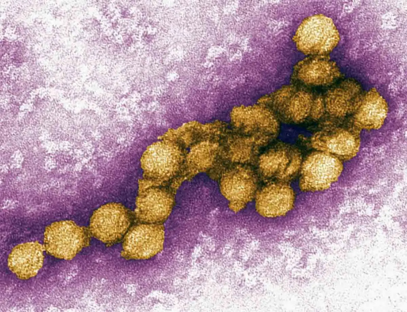 virus du nil occidental