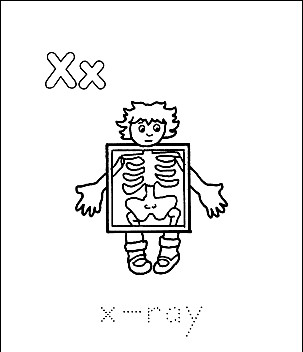 Buchstabe X 1