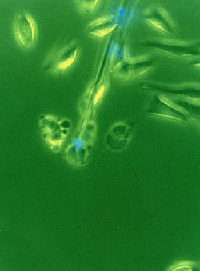 sonda nanosensor carregando um feixe de laser