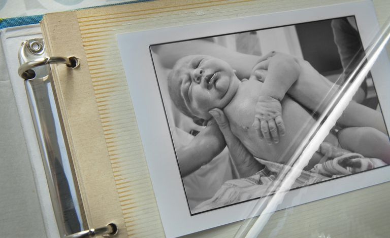 Existem várias técnicas disponíveis para ajudá-lo a remover com segurança fotos de álbuns antigos como este.