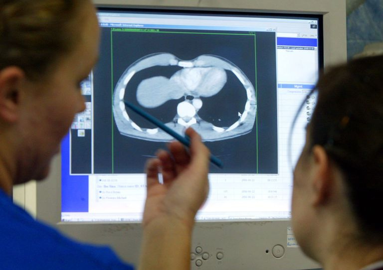 Médicos verificando resultado de MRI