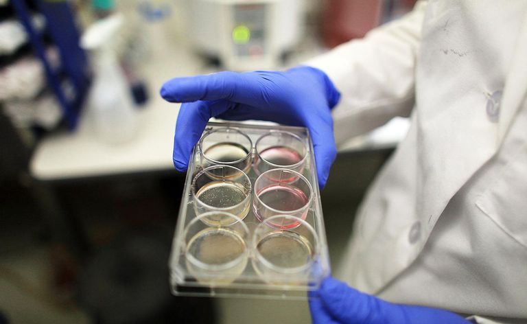 Gli scienziati continuano la ricerca sulle cellule staminali mentre i tribunali discutono sul divieto