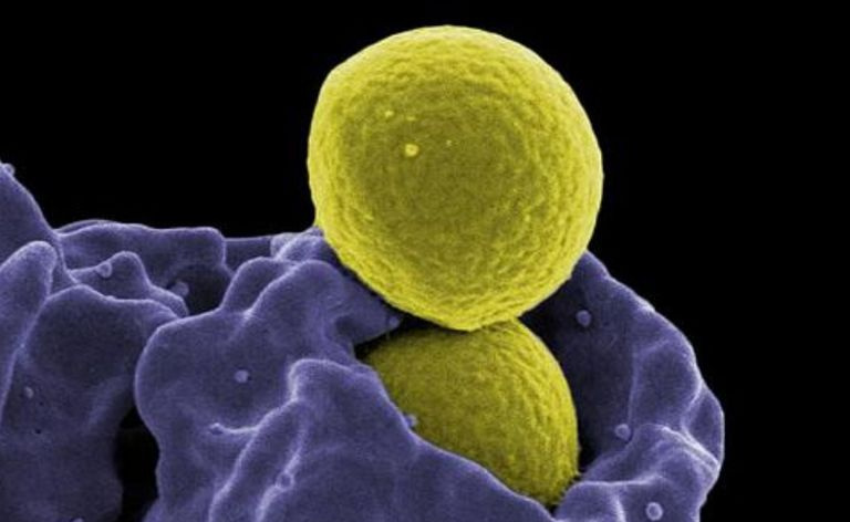MRSA 細菌