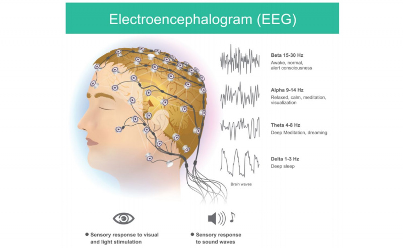 EEG