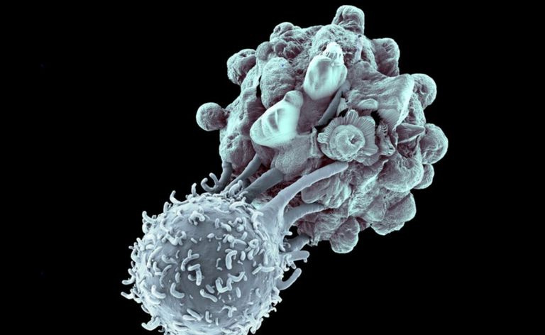 Killer T Cell