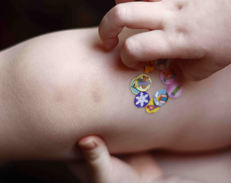 Adesivi su un bambino