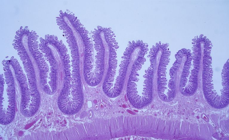 Et lysmikroskop som viser en histologisk forberedelse av tarmslimhinnen