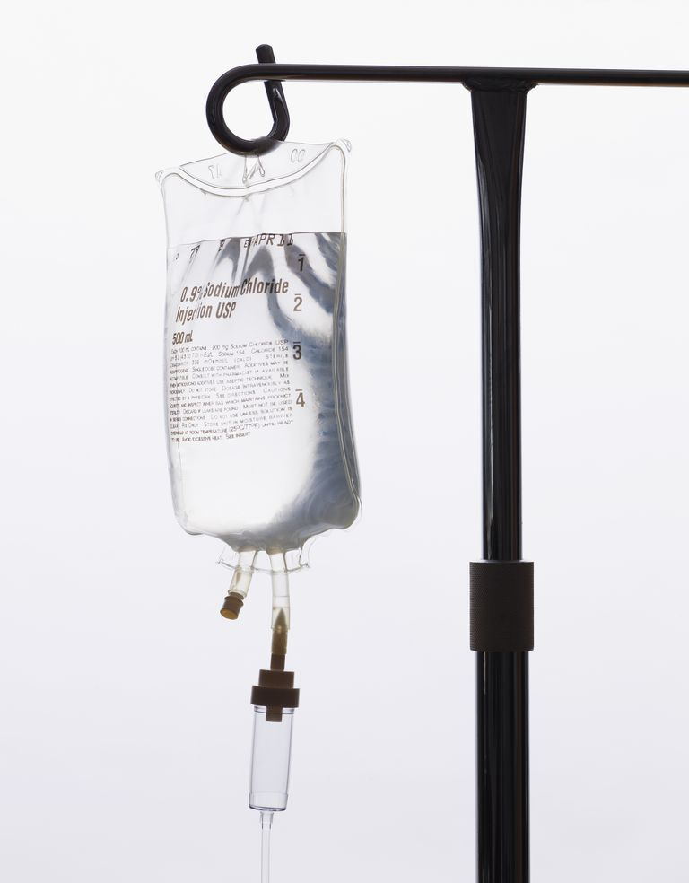 Intravenoza fizioloģiskā šķīduma pilināšana uz IV staba.